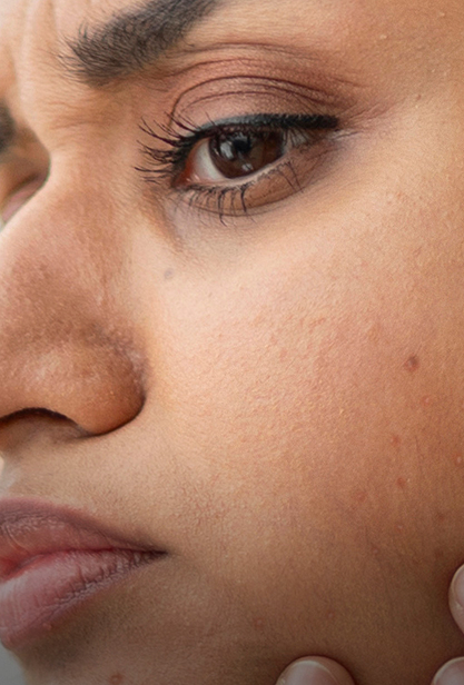 Dullness & Uneven Tone